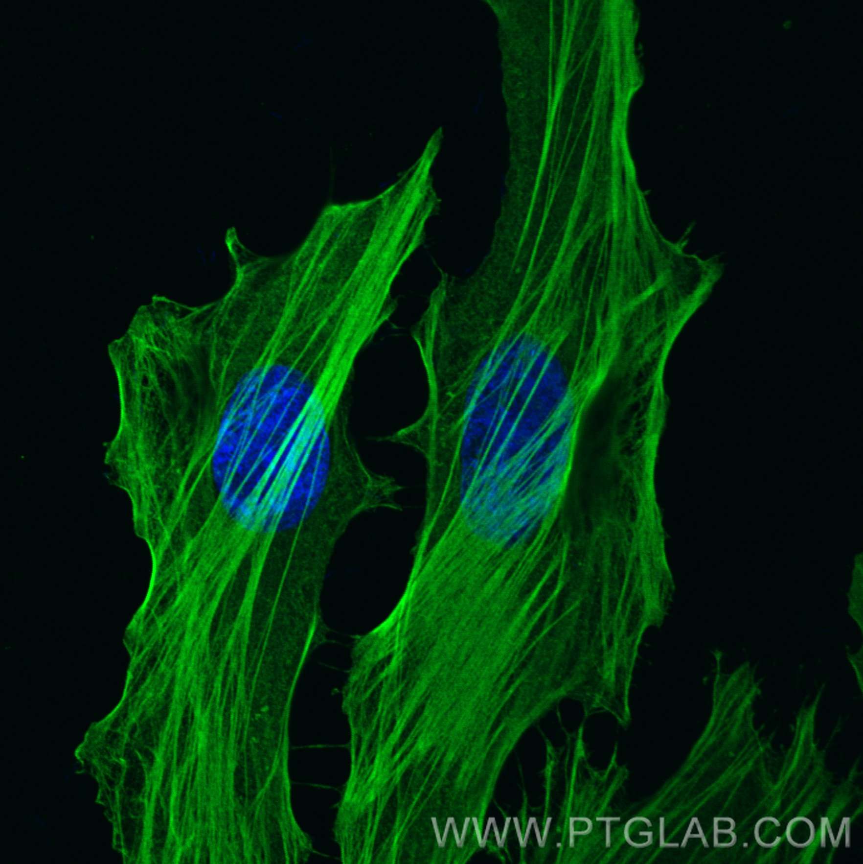 Immunofluorescence (IF) / fluorescent staining of HeLa cells using FLNA Monoclonal antibody (67133-1-Ig)