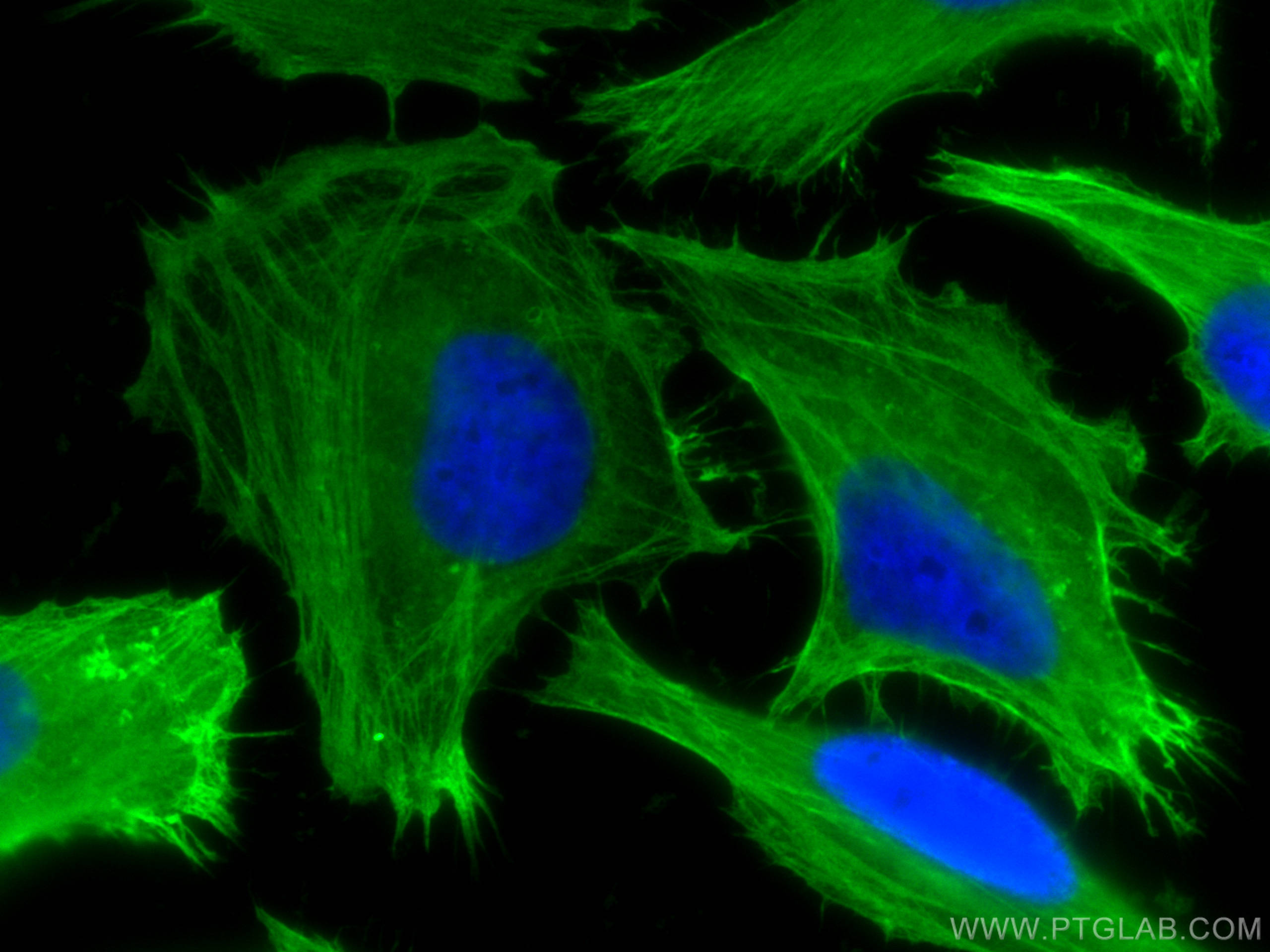 Immunofluorescence (IF) / fluorescent staining of HeLa cells using FLNA Monoclonal antibody (67133-1-Ig)