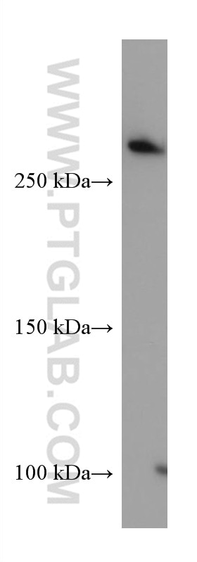 Western Blot (WB) analysis of human skeletal muscle tissue using FLNA Monoclonal antibody (67133-1-Ig)