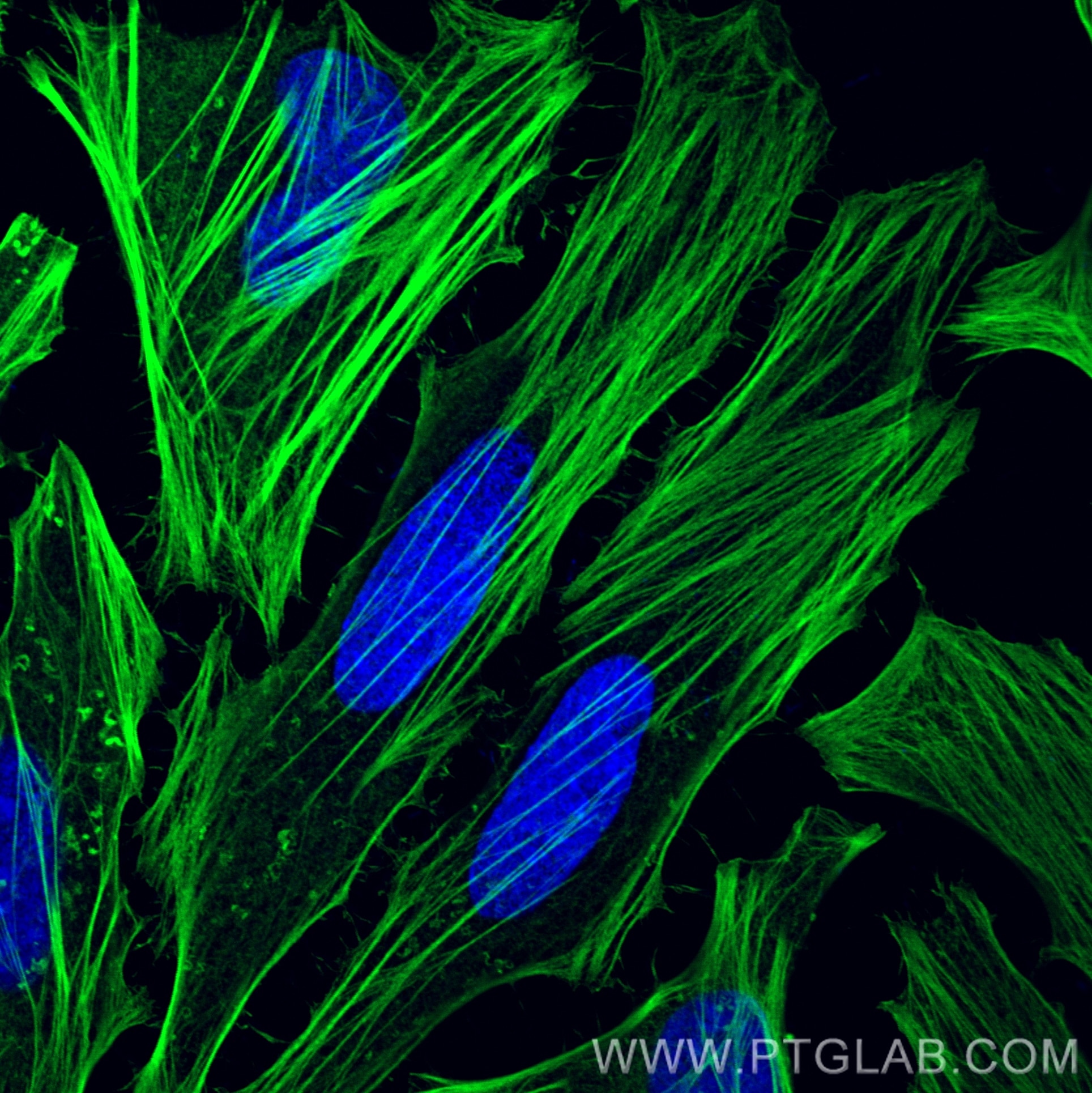 Immunofluorescence (IF) / fluorescent staining of HeLa cells using CoraLite® Plus 488-conjugated FLNA Monoclonal anti (CL488-67133)