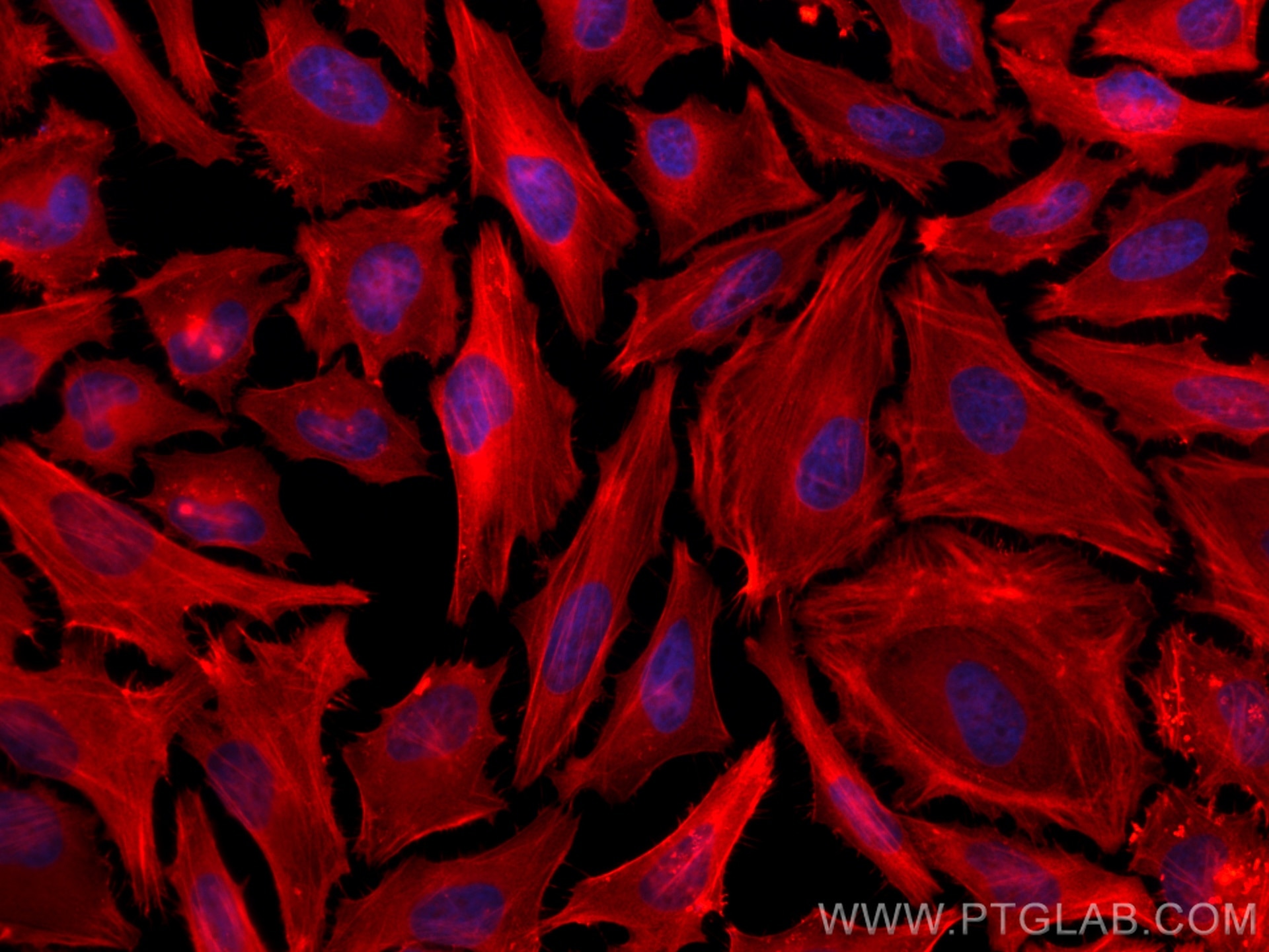 Immunofluorescence (IF) / fluorescent staining of HeLa cells using CoraLite®594-conjugated FLNA Monoclonal antibody (CL594-67133)