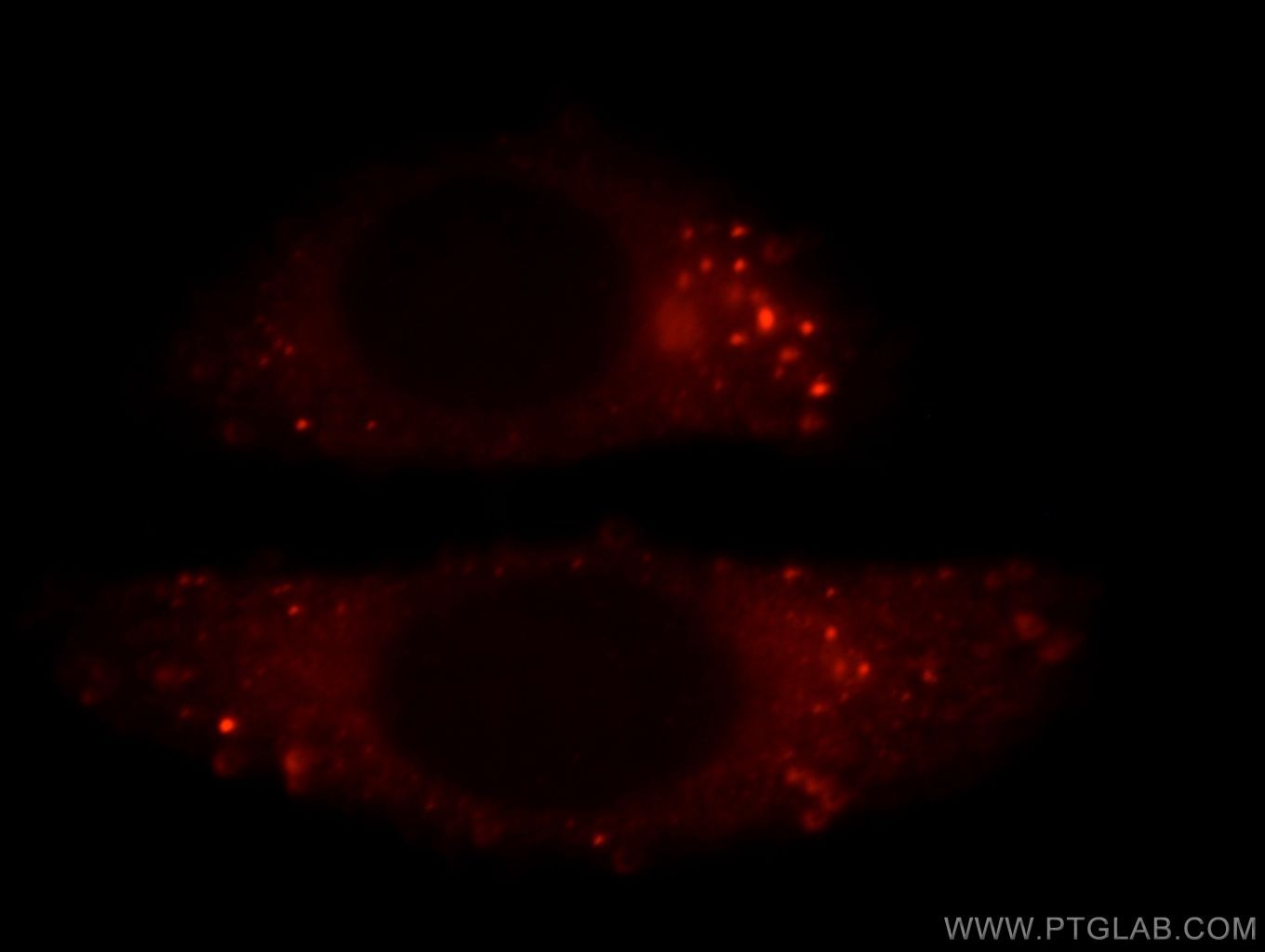 Immunofluorescence (IF) / fluorescent staining of HepG2 cells using FLNB Polyclonal antibody (20685-1-AP)