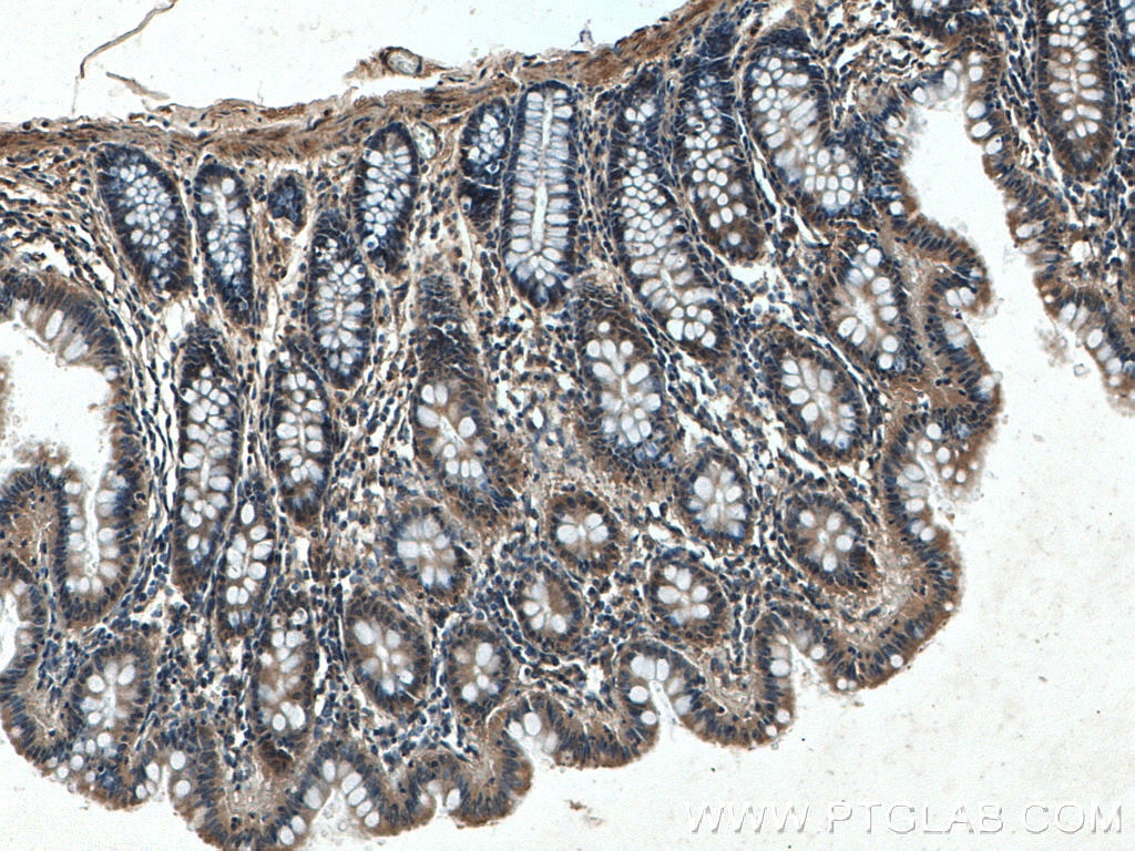 Immunohistochemistry (IHC) staining of human colon tissue using FLNB Polyclonal antibody (20685-1-AP)