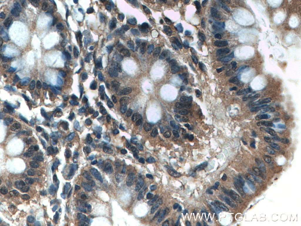 Immunohistochemistry (IHC) staining of human colon tissue using FLNB Polyclonal antibody (20685-1-AP)