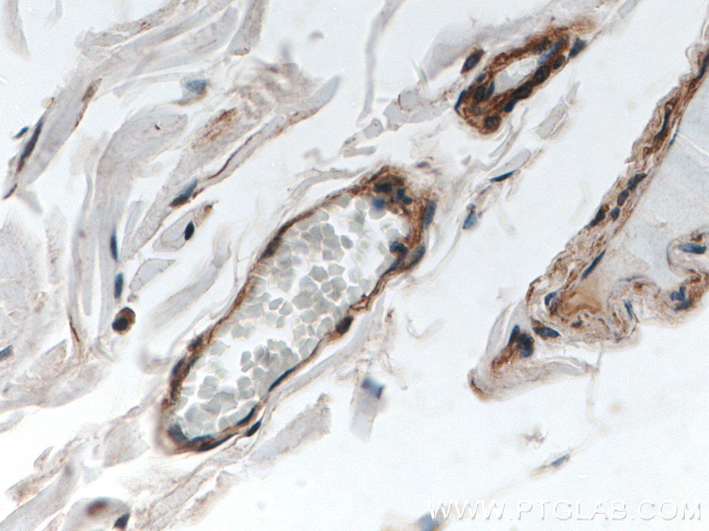 Immunohistochemistry (IHC) staining of human colon tissue using FLNB Polyclonal antibody (20685-1-AP)