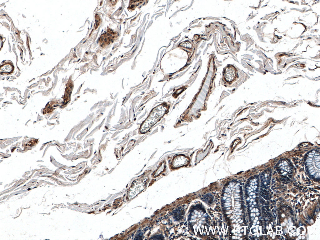Immunohistochemistry (IHC) staining of human colon tissue using FLNB Polyclonal antibody (20685-1-AP)