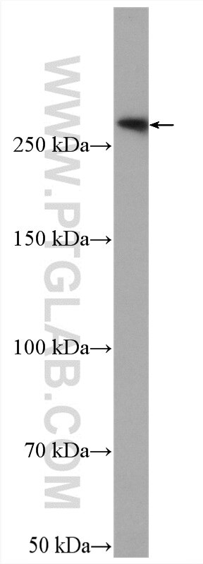 Western Blot (WB) analysis of U2OS cells using FLNB Polyclonal antibody (20685-1-AP)