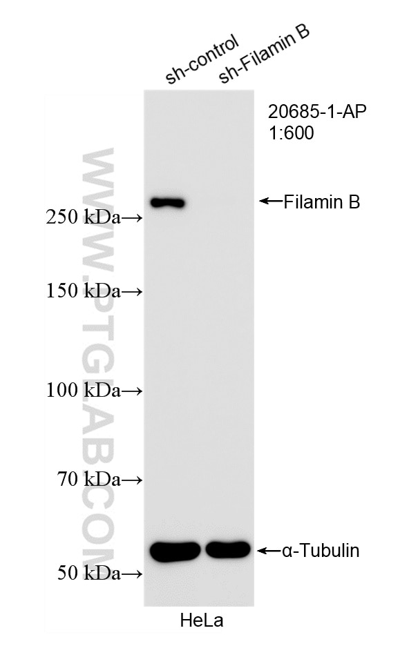 WB analysis of HeLa using 20685-1-AP Western Blot (WB) analysis of HeLa cells using Filamin B Polyclonal antibody (20685-1-AP)