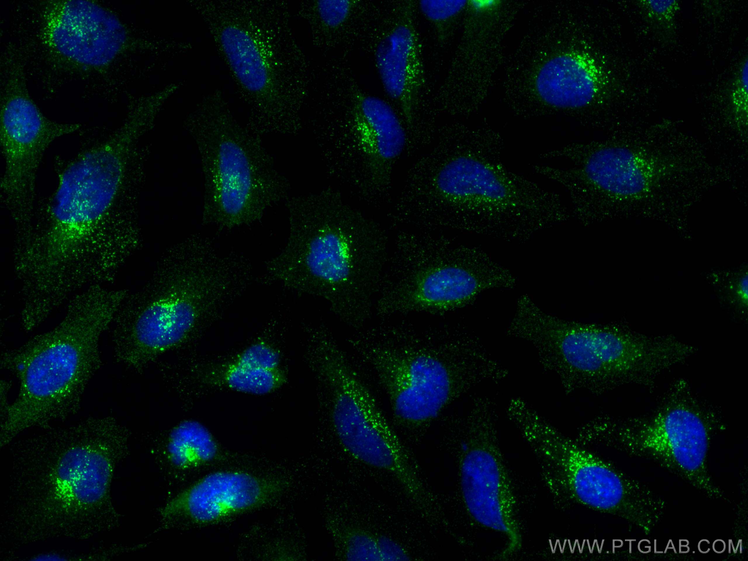 Immunofluorescence (IF) / fluorescent staining of HeLa cells using Flotillin 1 Polyclonal antibody (15571-1-AP)