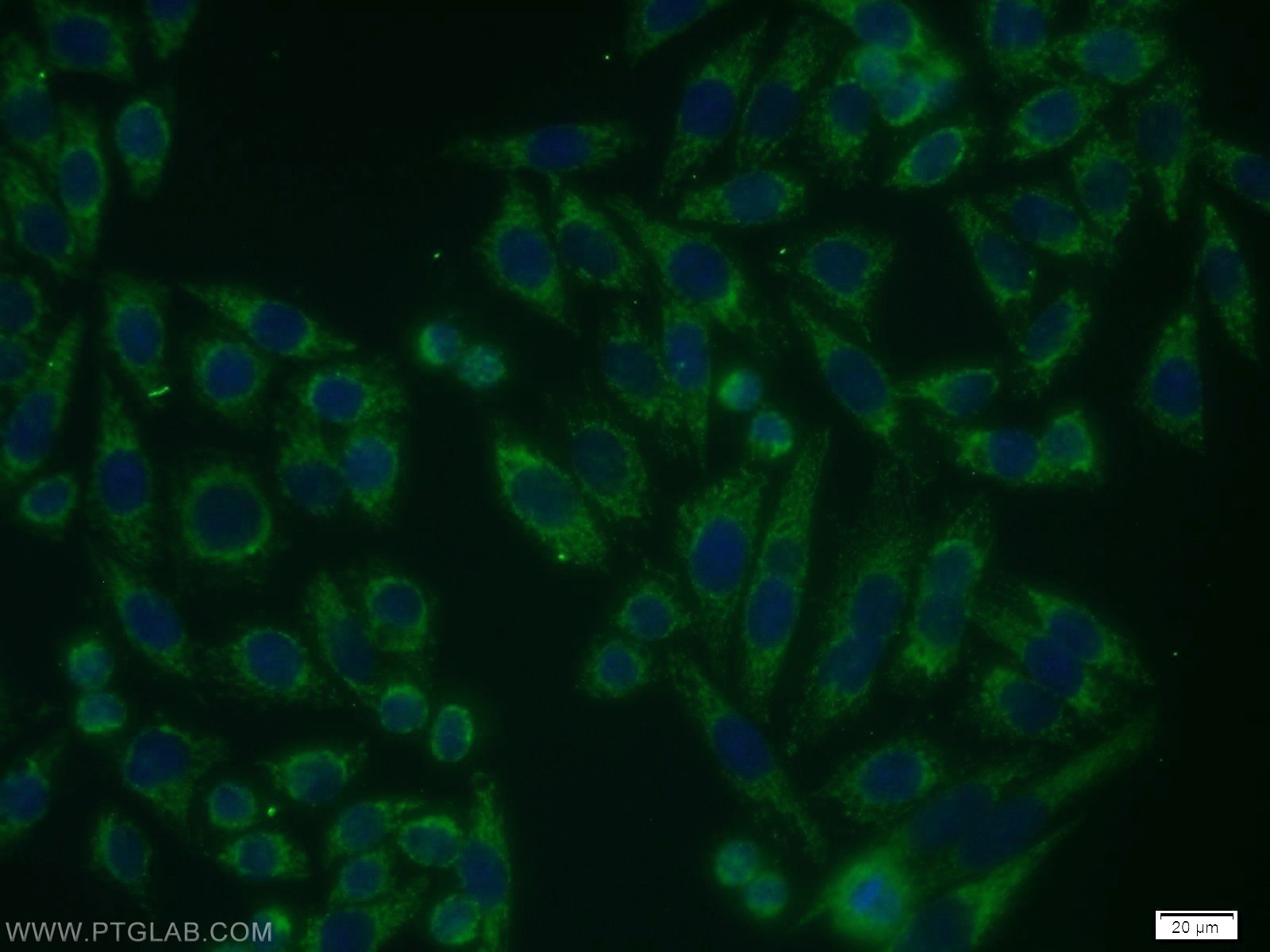 Immunofluorescence (IF) / fluorescent staining of HeLa cells using VEGFR-1/FLT-1 Polyclonal antibody (13687-1-AP)
