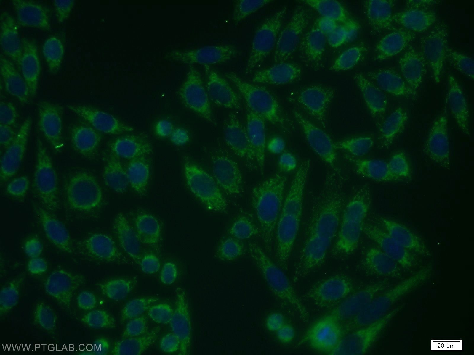 IF Staining of HeLa using 13687-1-AP