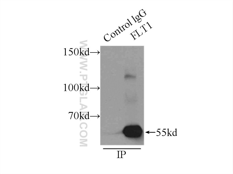 Immunoprecipitation (IP) experiment of A549 cells using VEGFR-1/FLT-1 Polyclonal antibody (13687-1-AP)
