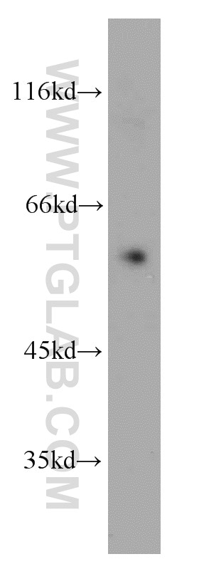 Western Blot (WB) analysis of human placenta tissue using VEGFR-1/FLT-1 Polyclonal antibody (13687-1-AP)