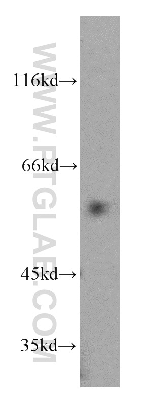 Western Blot (WB) analysis of mouse lung tissue using VEGFR-1/FLT-1 Polyclonal antibody (13687-1-AP)