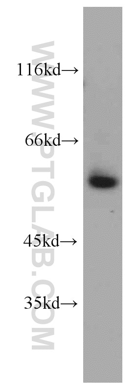 Western Blot (WB) analysis of HEK-293 cells using VEGFR-1/FLT-1 Polyclonal antibody (13687-1-AP)