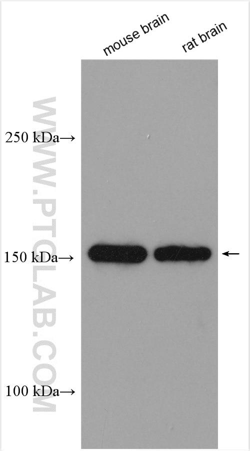 Western Blot (WB) analysis of various lysates using FLT3 Polyclonal antibody (21049-1-AP)