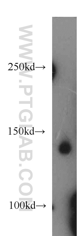 Western Blot (WB) analysis of mouse brain tissue using FLT3 Polyclonal antibody (21049-1-AP)