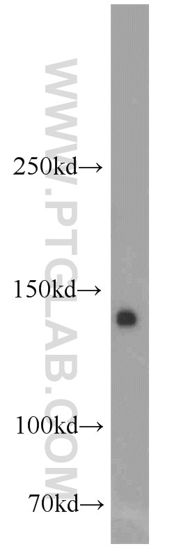 FLT3 Polyclonal antibody