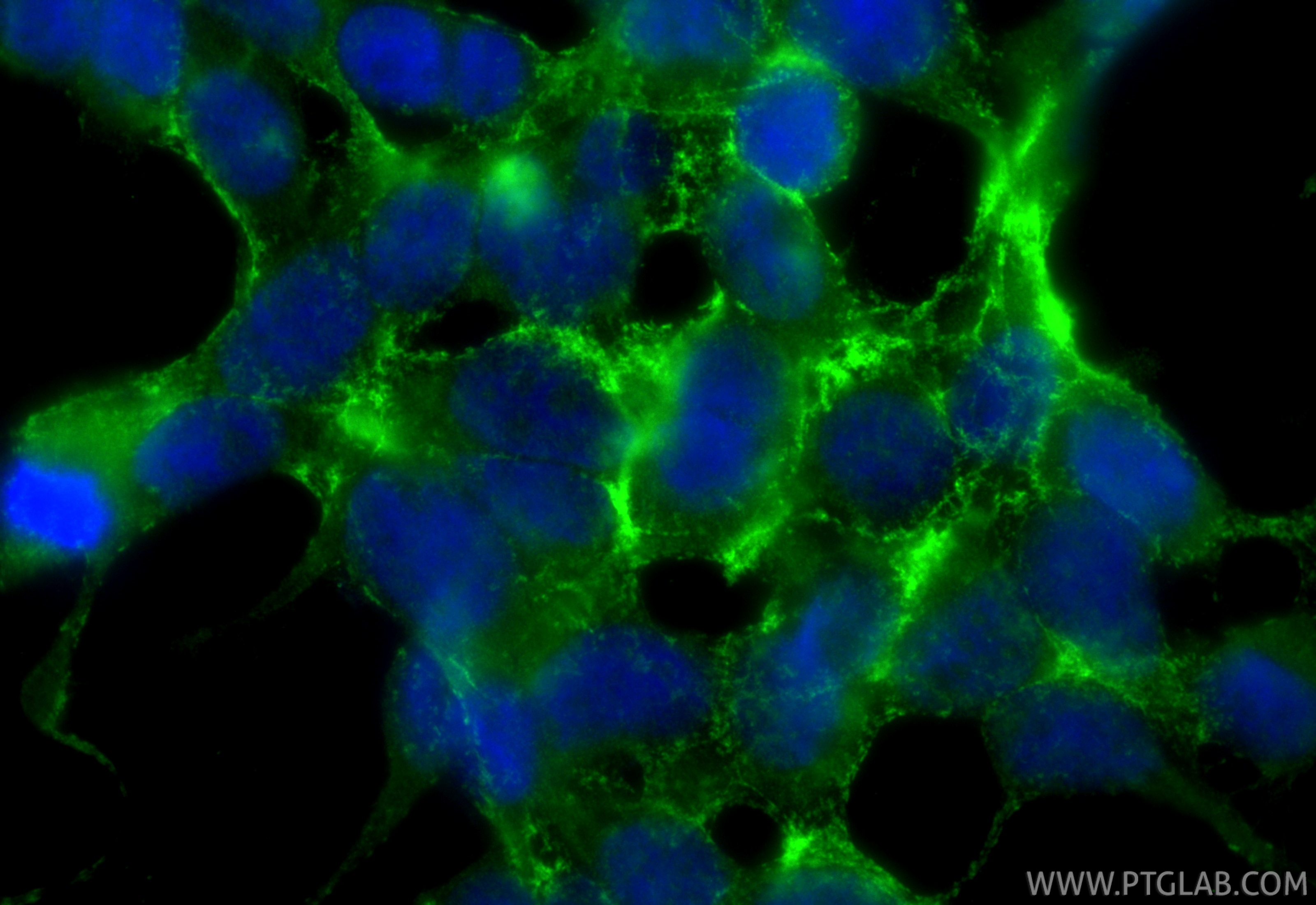 Immunofluorescent analysis of (-20°C Ethanol) fixed HEK-293 cells using FLT3 antibody (30297-1-AP) at dilution of 1:400 and CoraLite®488-Conjugated Goat Anti-Rabbit IgG(H+L) (SA00013-2). Immunofluorescence (IF) / fluorescent staining of HEK-293 cells using FLT3 Polyclonal antibody (30297-1-AP)