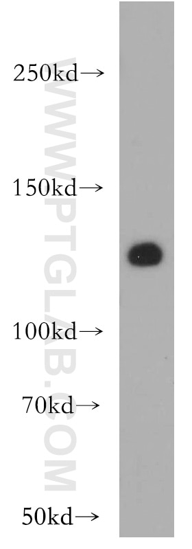 Western Blot (WB) analysis of mouse spleen tissue using VEGFR3 Polyclonal antibody (20712-1-AP)