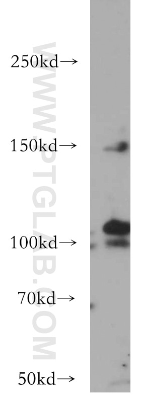 Western Blot (WB) analysis of HeLa cells using VEGFR3 Polyclonal antibody (20712-1-AP)