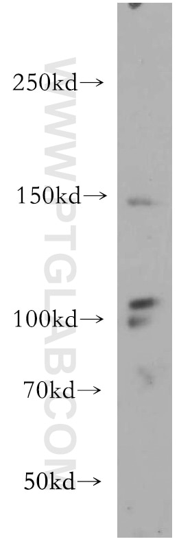 VEGFR3 Polyclonal antibody
