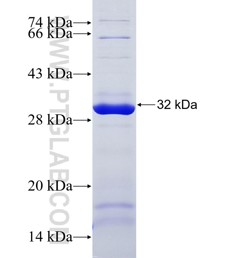 FLT4 fusion protein Ag33909 SDS-PAGE FLT4 fusion protein Ag33909 SDS-PAGE