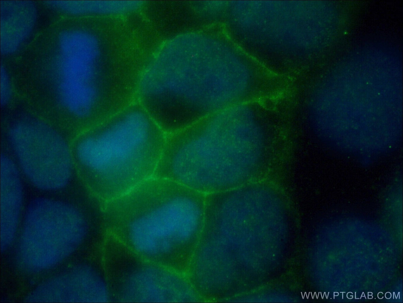 Immunofluorescence (IF) / fluorescent staining of Caco-2 cells using FLVCR1 Polyclonal antibody (26841-1-AP)
