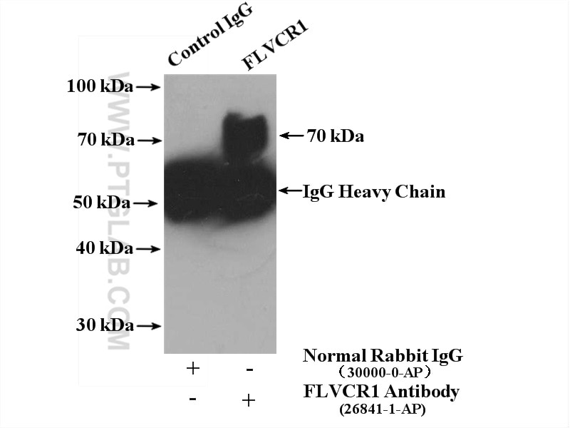 Immunoprecipitation (IP) experiment of K-562 cells using FLVCR1 Polyclonal antibody (26841-1-AP)