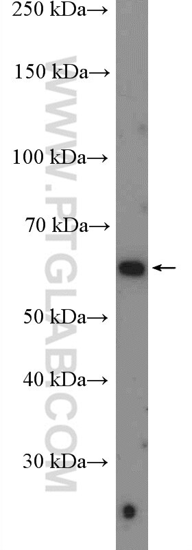 Western Blot (WB) analysis of human placenta tissue using FLVCR1 Polyclonal antibody (26841-1-AP)