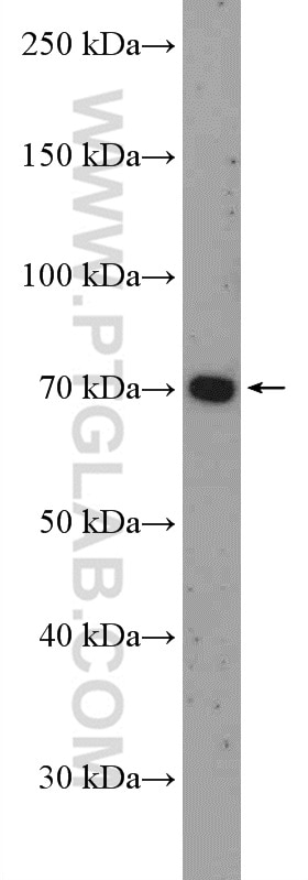 Western Blot (WB) analysis of K-562 cells using FLVCR1 Polyclonal antibody (26841-1-AP)