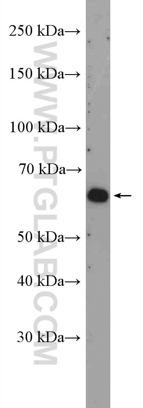 Western Blot (WB) analysis of Jurkat cells using FLVCR1 Polyclonal antibody (26841-1-AP)