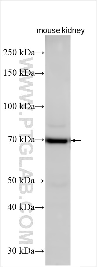 Various lysates were subjected to SDS PAGE followed by western blot with 26841-1-AP (FLVCR1 antibody) at dilution of 1:600 incubated at room temperature for 1.5 hours. Western Blot (WB) analysis of various lysates using FLVCR1 Polyclonal antibody (26841-1-AP)