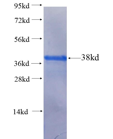 FLVCR1 fusion protein Ag25220 SDS-PAGE