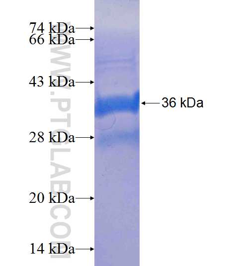 FLVCR2 fusion protein Ag24928 SDS-PAGE