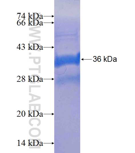 FLVCR2 fusion protein Ag24928 SDS-PAGE