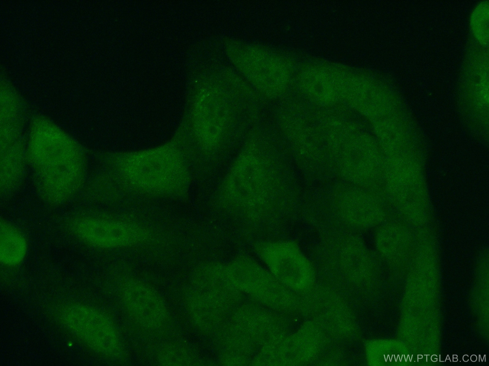Immunofluorescence (IF) / fluorescent staining of A549 cells using FMN1 Polyclonal antibody (25982-1-AP)