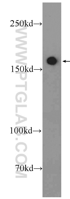 Western Blot (WB) analysis of A549 cells using FMN1 Polyclonal antibody (25982-1-AP)