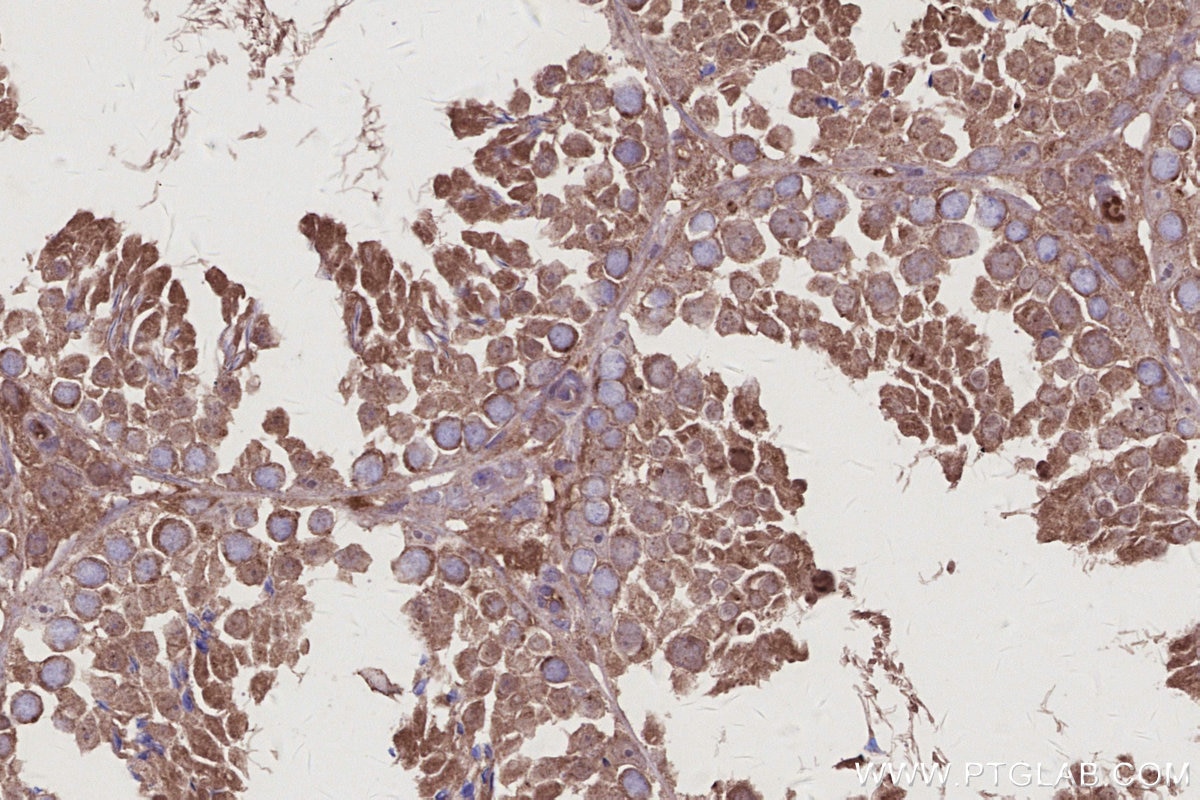 Immunohistochemistry (IHC) staining of mouse testis tissue using FMN2 Polyclonal antibody (11259-1-AP)