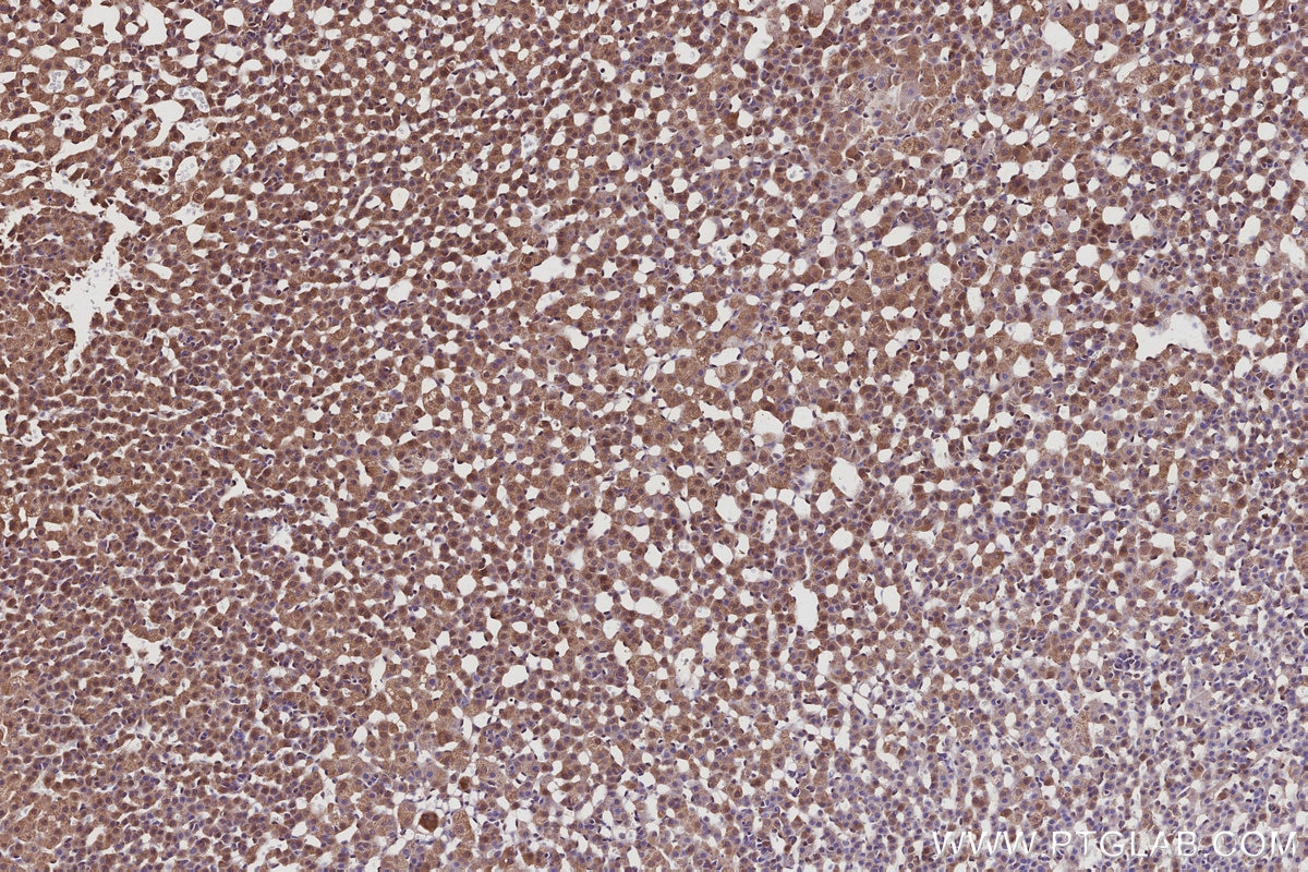 Immunohistochemistry (IHC) staining of rat adrenal gland tissue using FMN2 Polyclonal antibody (11259-1-AP)