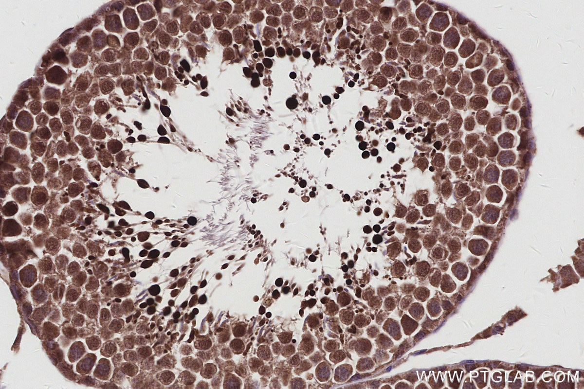 Immunohistochemistry (IHC) staining of rat testis tissue using FMN2 Polyclonal antibody (11259-1-AP)