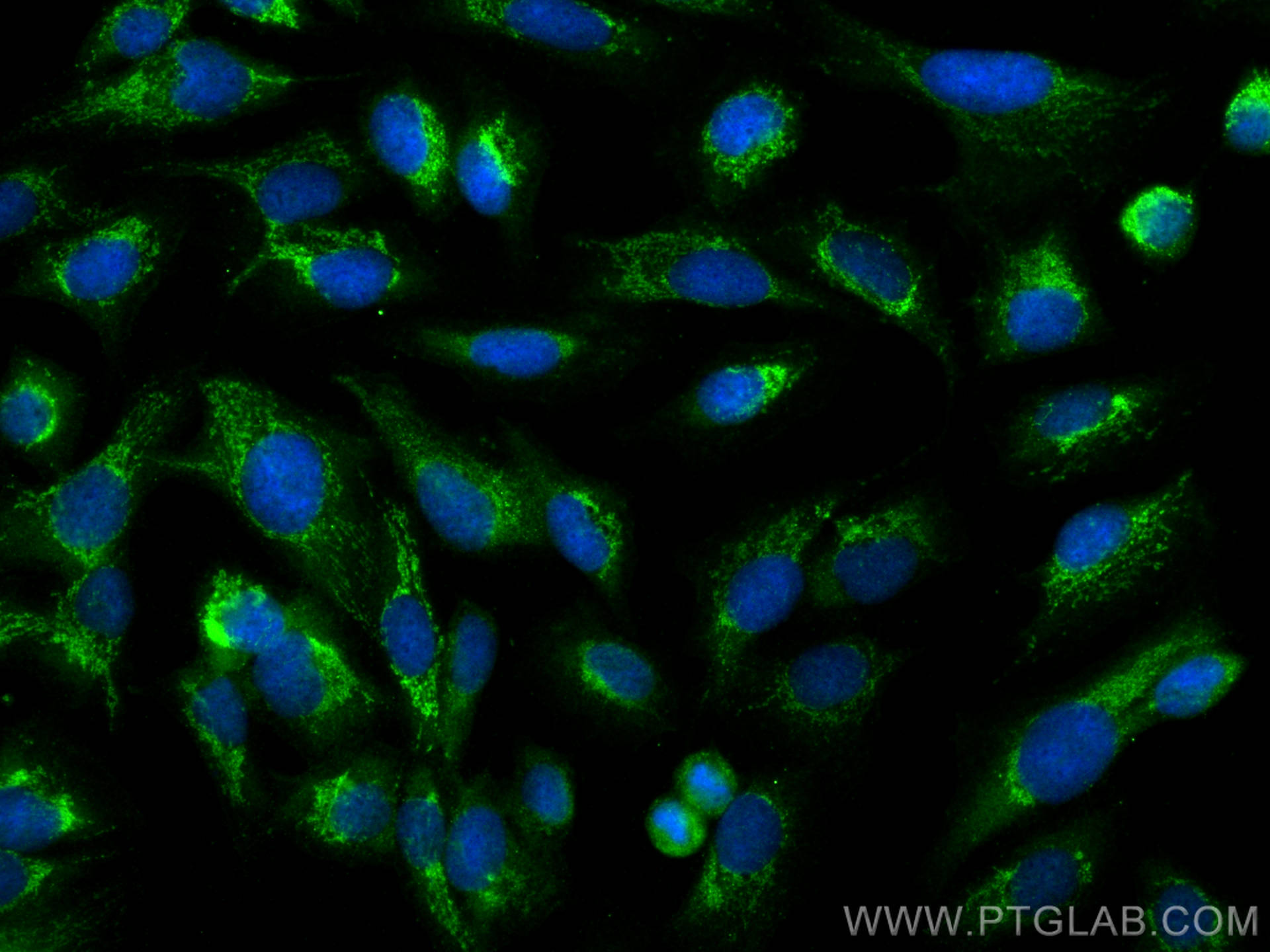 Immunofluorescence (IF) / fluorescent staining of U2OS cells using FMNL1 Polyclonal antibody (10395-1-AP)