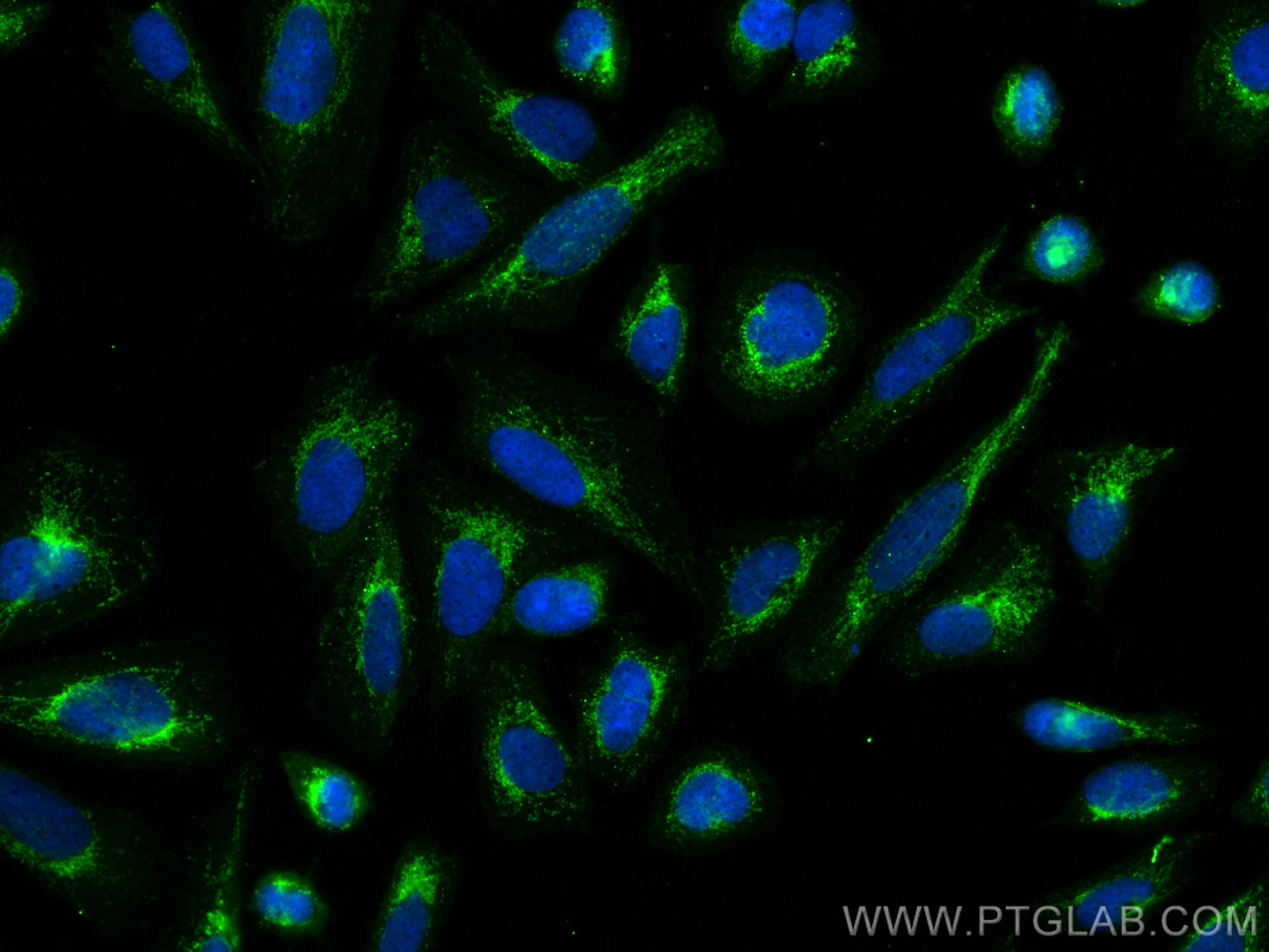 Immunofluorescence (IF) / fluorescent staining of Saos-2 cells using FMNL1 Polyclonal antibody (10395-1-AP)