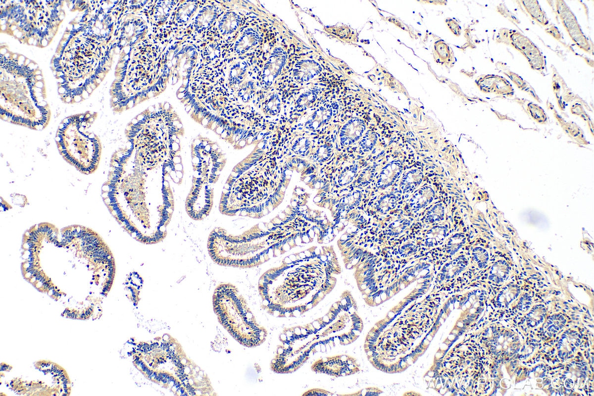 IHC staining of human small intestine using 10395-1-AP