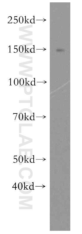 Western Blot (WB) analysis of HeLa cells using FMNL1 Polyclonal antibody (10395-1-AP)