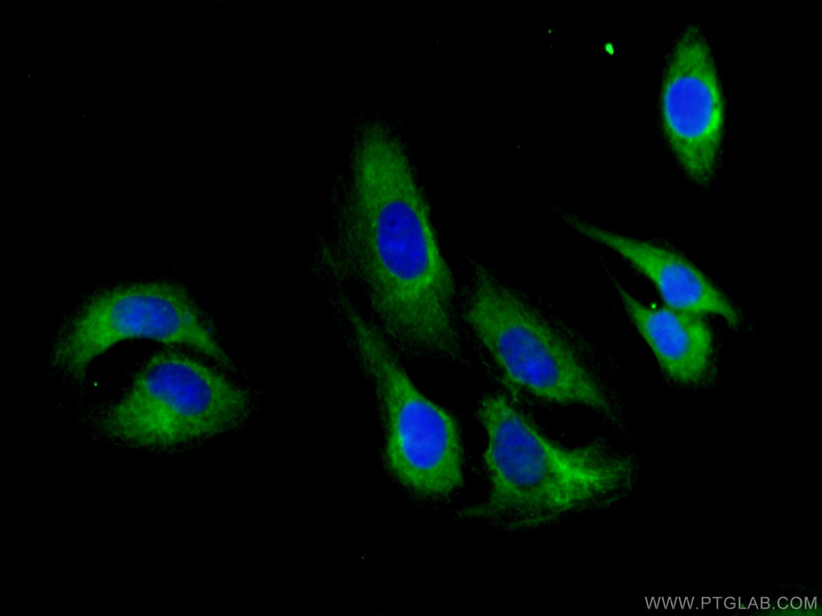 Immunofluorescence (IF) / fluorescent staining of U2OS cells using FMNL1 Polyclonal antibody (27834-1-AP)
