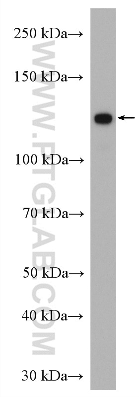 Western Blot (WB) analysis of Jurkat cells using FMNL1 Polyclonal antibody (27834-1-AP)