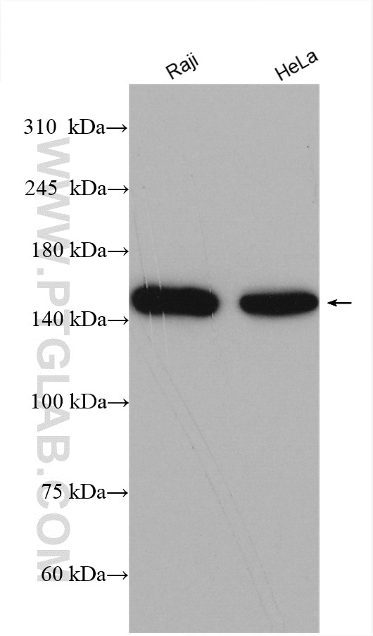 Western Blot (WB) analysis of various lysates using FMNL1 Polyclonal antibody (27834-1-AP)
