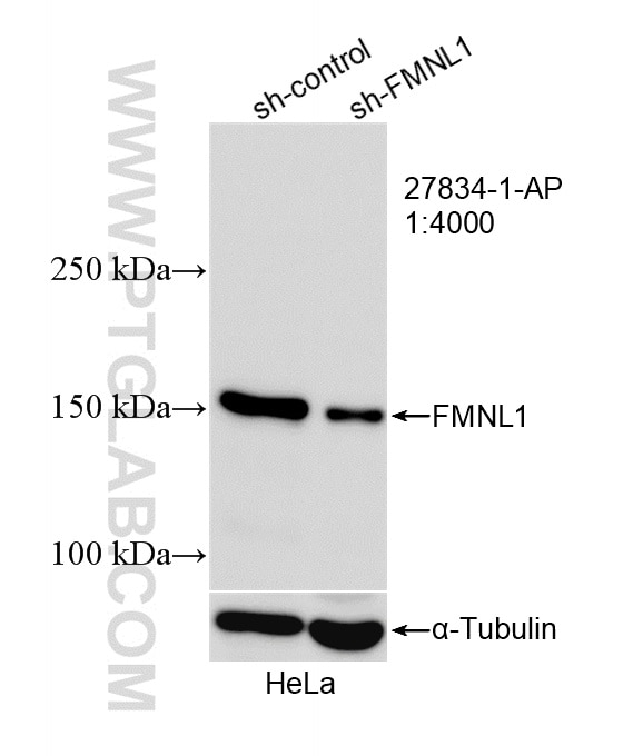 Western Blot (WB) analysis of HeLa cells using FMNL1 Polyclonal antibody (27834-1-AP)