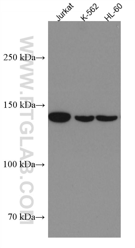 WB analysis using 67587-1-Ig